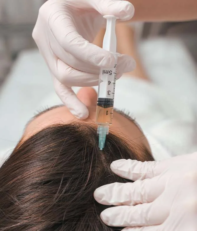 prp treatment